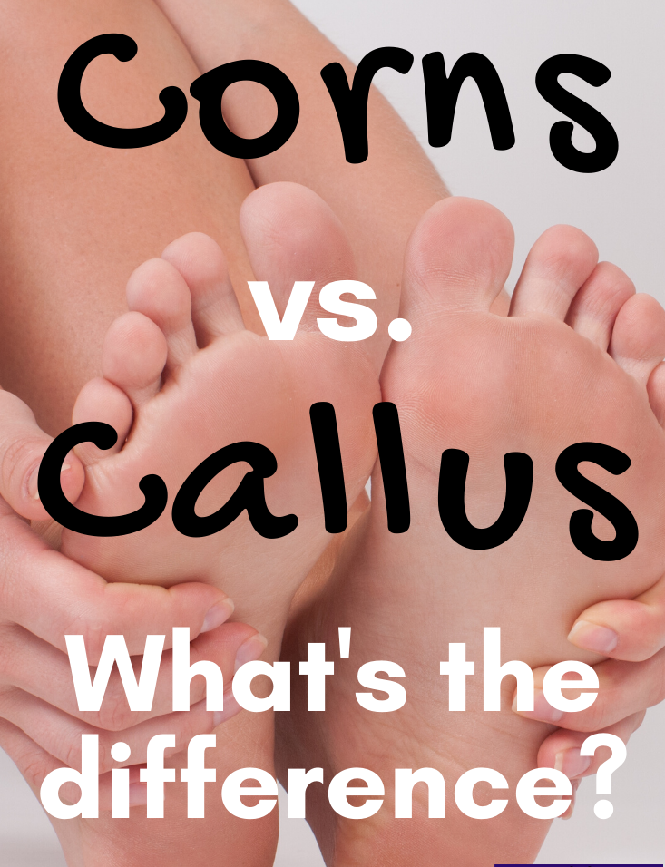 Corn vs. Callus: Body Parts, How They Form, Removal