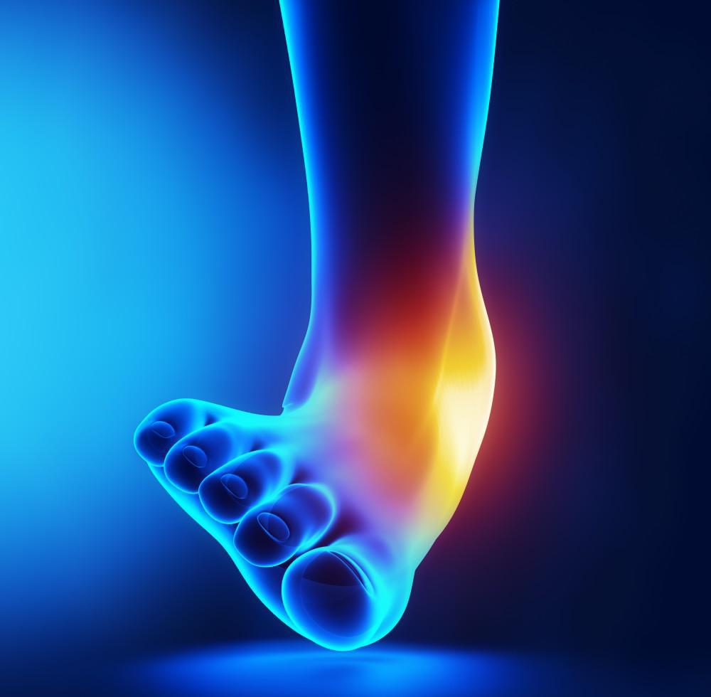 ANKLE PAIN Check out our latest blog for more information! Total